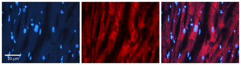 A2M Rabbit Polyclonal Antibody