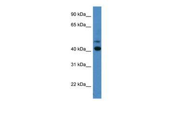 OPN1SW Rabbit Polyclonal Antibody