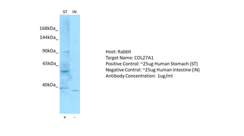 COL27A1 Rabbit Polyclonal Antibody
