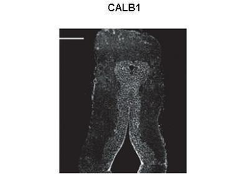 CALB1 Rabbit Polyclonal Antibody