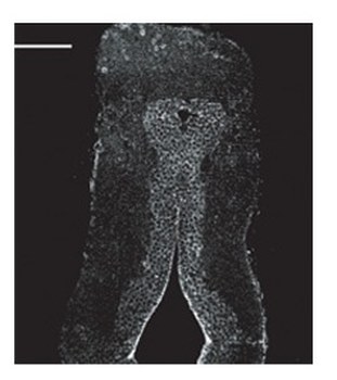 CALB1 Rabbit Polyclonal Antibody