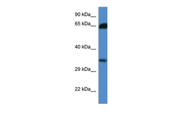 MGC3207 Rabbit Polyclonal Antibody