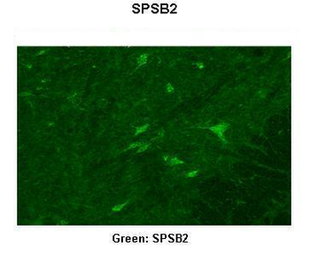 SPSB2 Rabbit Polyclonal Antibody