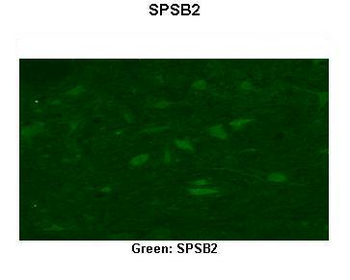 SPSB2 Rabbit Polyclonal Antibody