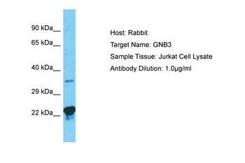 GNB3 Rabbit Polyclonal Antibody