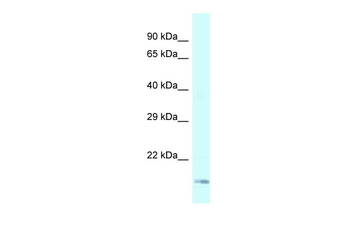 GEMIN6 Rabbit Polyclonal Antibody