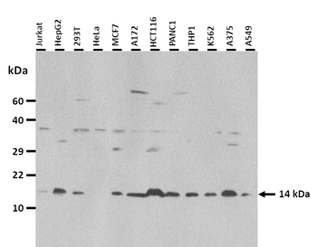 SAA2 Rabbit Polyclonal Antibody