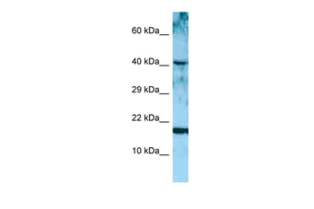 ARTN Rabbit Polyclonal Antibody