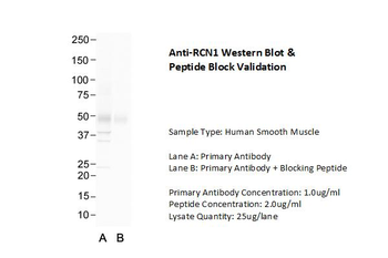 RCN1 Rabbit Polyclonal Antibody