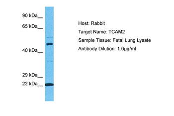 TICAM2 Rabbit Polyclonal Antibody