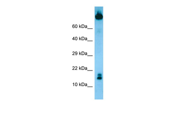 TCL1B Rabbit Polyclonal Antibody