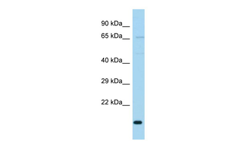 TIMM23B Rabbit Polyclonal Antibody