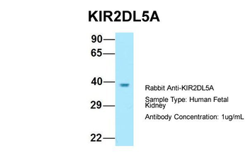 KIR2DL5A Rabbit Polyclonal Antibody