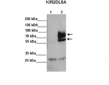 KIR2DL5A Rabbit Polyclonal Antibody