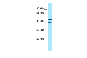 KIR2DL5A Rabbit Polyclonal Antibody