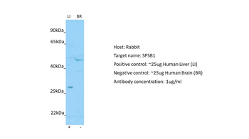 SPSB1 Rabbit Polyclonal Antibody