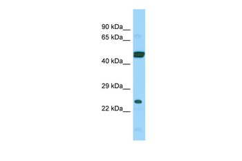 ARL6IP4 Rabbit Polyclonal Antibody