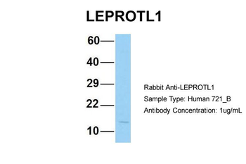 LEPROTL1 Rabbit Polyclonal Antibody