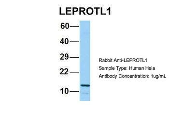 LEPROTL1 Rabbit Polyclonal Antibody
