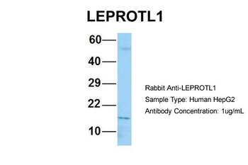 LEPROTL1 Rabbit Polyclonal Antibody