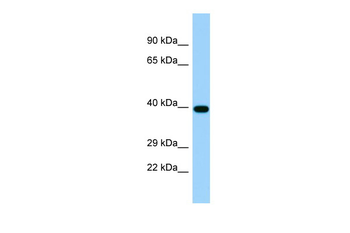 TIRAP3 Rabbit Polyclonal Antibody
