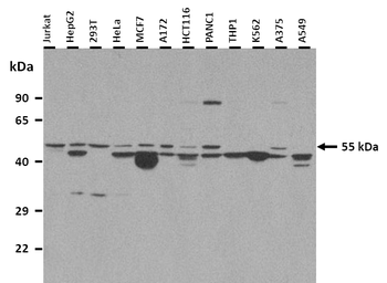 SPRTN Rabbit Polyclonal Antibody