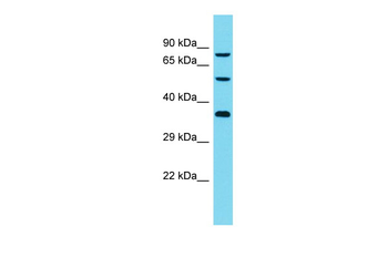 DCAF8L2 Rabbit Polyclonal Antibody