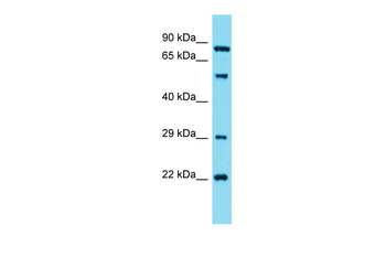 GUCY1A2 Rabbit Polyclonal Antibody