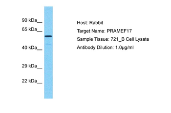 PRAMEF17 Rabbit Polyclonal Antibody