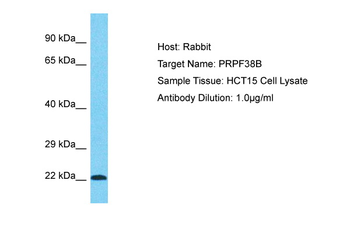 PRPF38B Rabbit Polyclonal Antibody