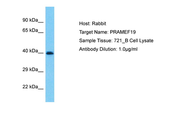 PRAMEF19 Rabbit Polyclonal Antibody