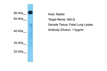 HELQ Rabbit Polyclonal Antibody
