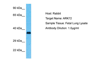 AKR7A2 Rabbit Polyclonal Antibody