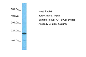 EIF5A Rabbit Polyclonal Antibody