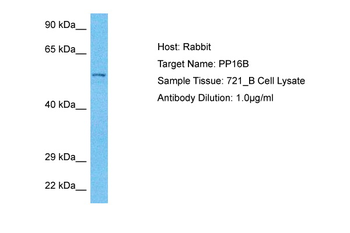 PPP1R16B Rabbit Polyclonal Antibody
