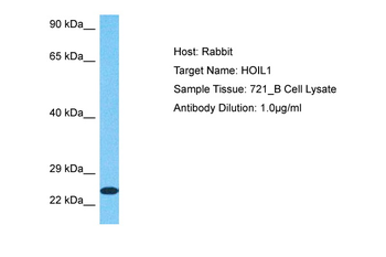 RBCK1 Rabbit Polyclonal Antibody