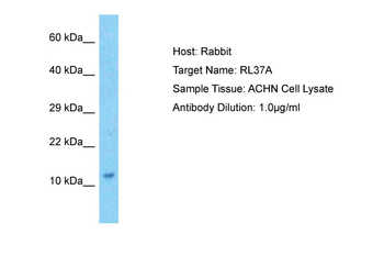 RPL37A Rabbit Polyclonal Antibody