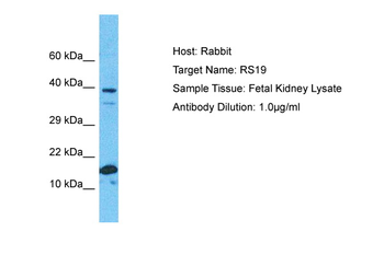 RPS19 Rabbit Polyclonal Antibody