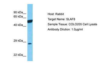 SLAMF8 Rabbit Polyclonal Antibody