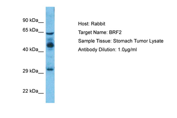 BRF2 Rabbit Polyclonal Antibody