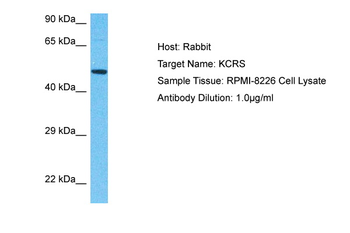 CKMT2 Rabbit Polyclonal Antibody