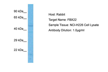 FBXO22 Rabbit Polyclonal Antibody