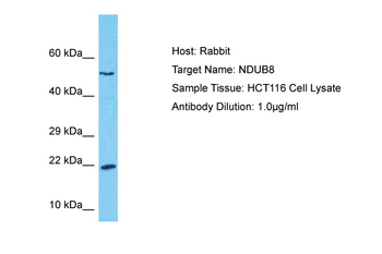NDUFB8 Rabbit Polyclonal Antibody