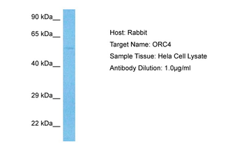 ORC4 Rabbit Polyclonal Antibody