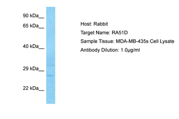 RAD51D Rabbit Polyclonal Antibody