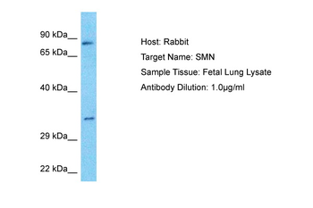 SMN1 Rabbit Polyclonal Antibody