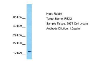 RNF7 Rabbit Polyclonal Antibody