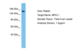 NPC1L1 Rabbit Polyclonal Antibody