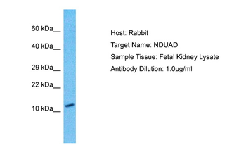 NDUFA13 Rabbit Polyclonal Antibody