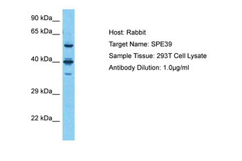 VIPAS39 Rabbit Polyclonal Antibody